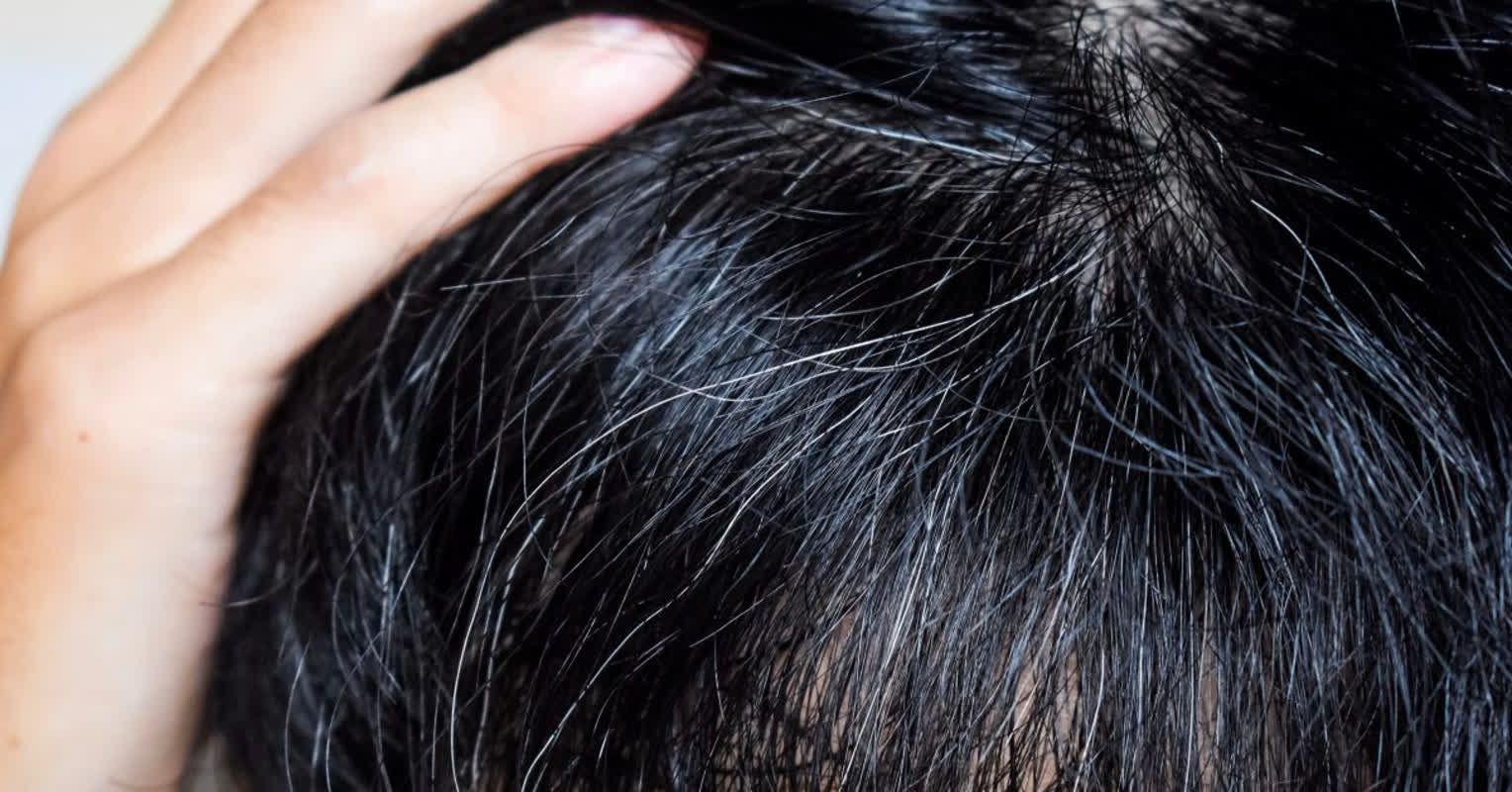 7 Surprising Reasons You’re Getting Gray Hair in Your 20s and 30s