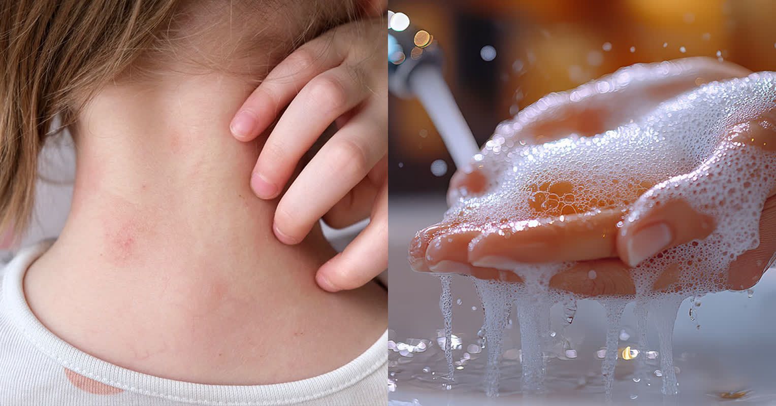 Scratching More This Season? Here’s What Could Be Triggering It